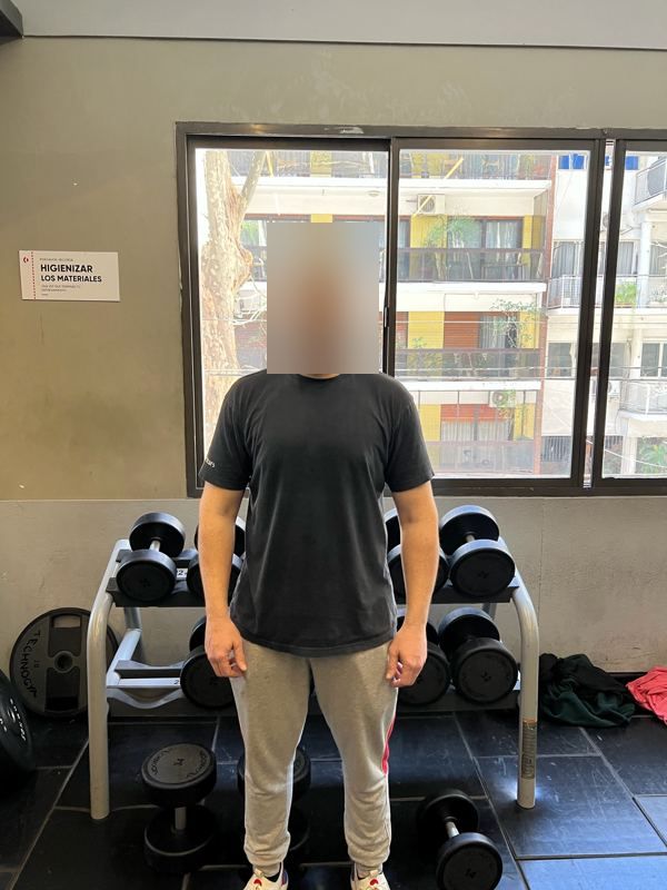 Martín F. después la asesoría con Jota (cara cubierta): foto de resultado de su transformación física
